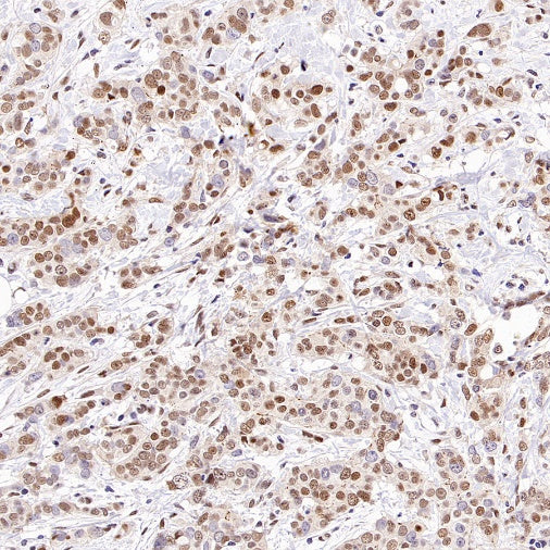 TDG Recombinant Rabbit mAb (S-3111-16)