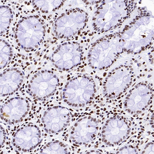 Histone H3 (acetyl K23) Recombinant Rabbit mAb (S-3321-202)