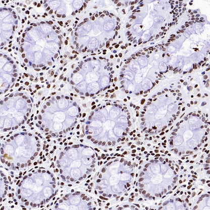 Histone H3 (acetyl K23) Recombinant Rabbit mAb (S-3321-202)