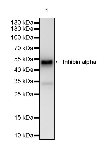 Inhibin alpha Recombinant Rabbit mAb (SDT-3212-24)