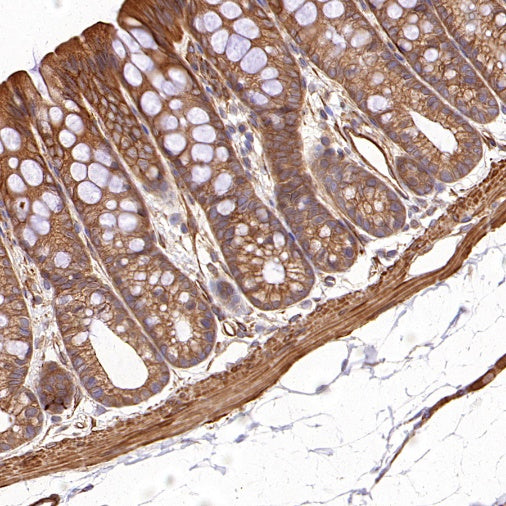 PFKL+PFKM Recombinant Rabbit mAb (S-1302-31)