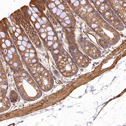 PFKL+PFKM Recombinant Rabbit mAb (S-1302-31)