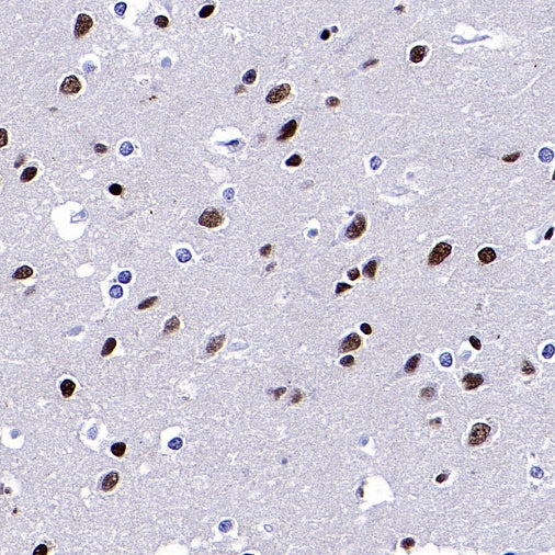 ARID1A Recombinant Rabbit mAb (S-440-62)