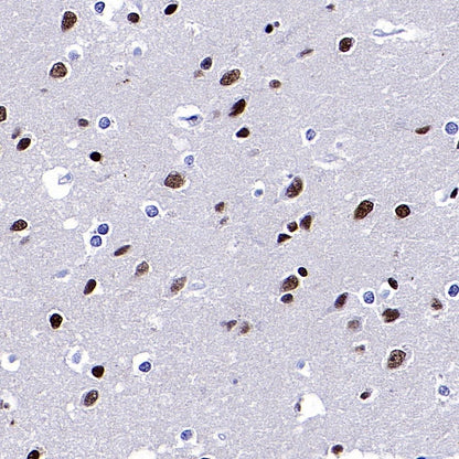 ARID1A Recombinant Rabbit mAb (S-440-62)