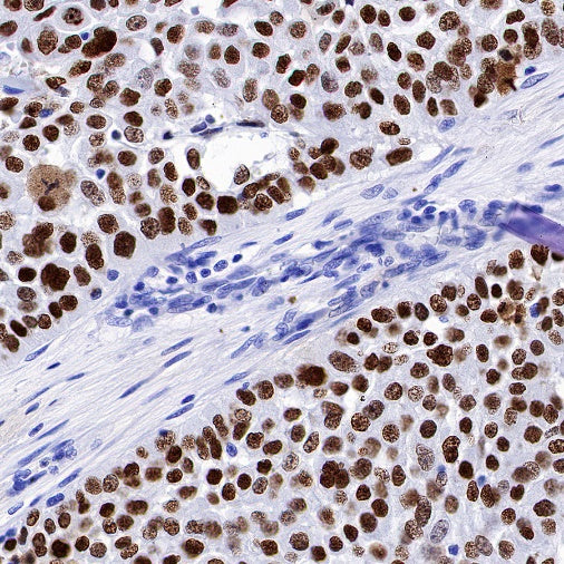 p63 Recombinant Rabbit mAb (SDT-054-137)