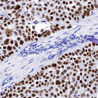 p63 Recombinant Rabbit mAb (SDT-054-137)