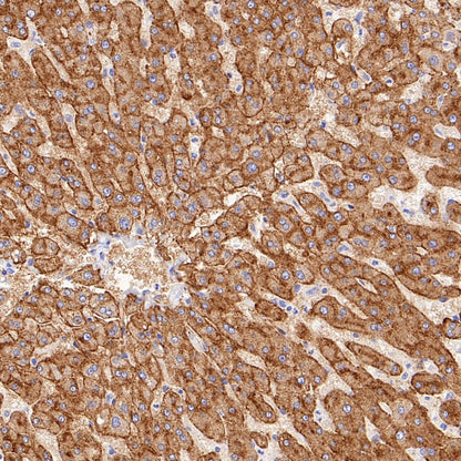 ASGR2 Recombinant Rabbit mAb (SDT-2059-47)