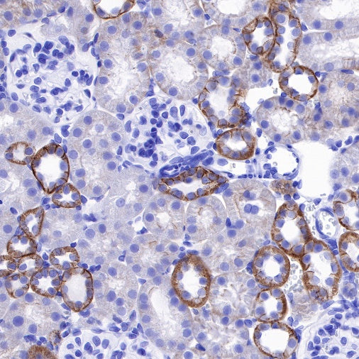E-Cadherin Recombinant Rabbit mAb (SDT-438-45)