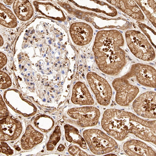 ALDH1A1 Rabbit Polyclonal Antibody