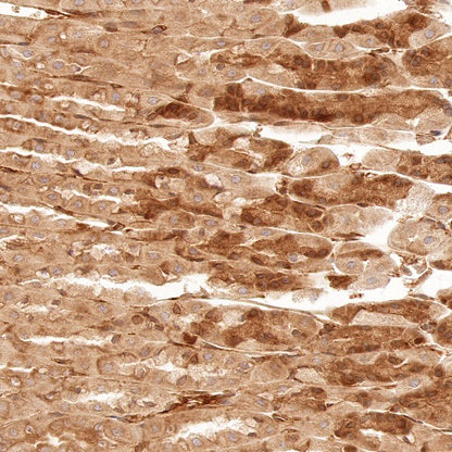 Argonaute-2 Recombinant Rabbit mAb (S-1826-47)