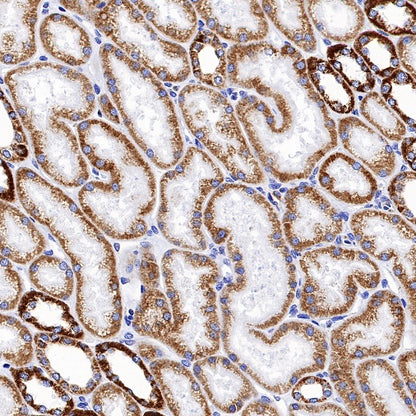 MTCO2 Rabbit Polyclonal Antibody