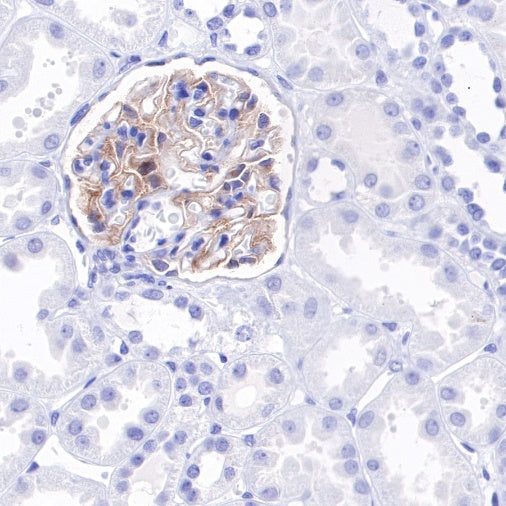 Tissue factor Recombinant Rabbit mAb (S-893-34)