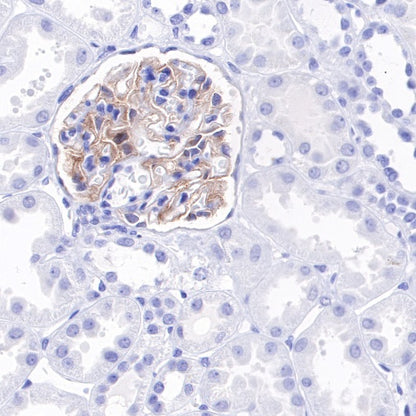 Tissue factor Recombinant Rabbit mAb (S-893-34)
