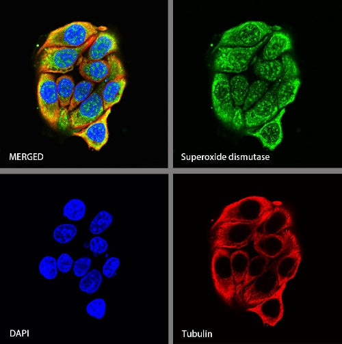 Superoxide dismutase Rabbit Polyclonal Antibody