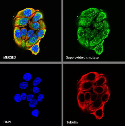 Superoxide dismutase Rabbit Polyclonal Antibody