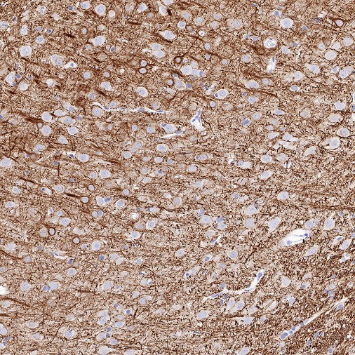 Neurofilament L Recombinant Rabbit mAb (S-635-214)