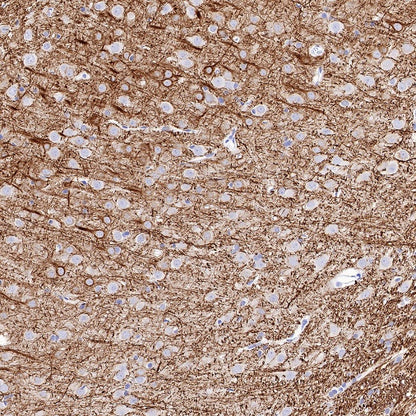 Neurofilament L Recombinant Rabbit mAb (S-635-214)