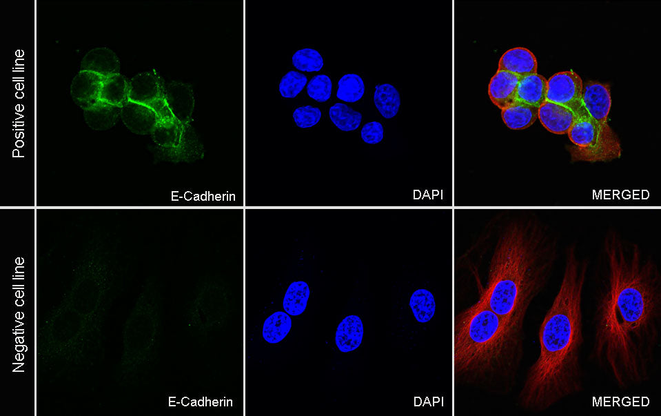 S-RMab® E-Cadherin Recombinant Rabbit mAb (SDT-R088)