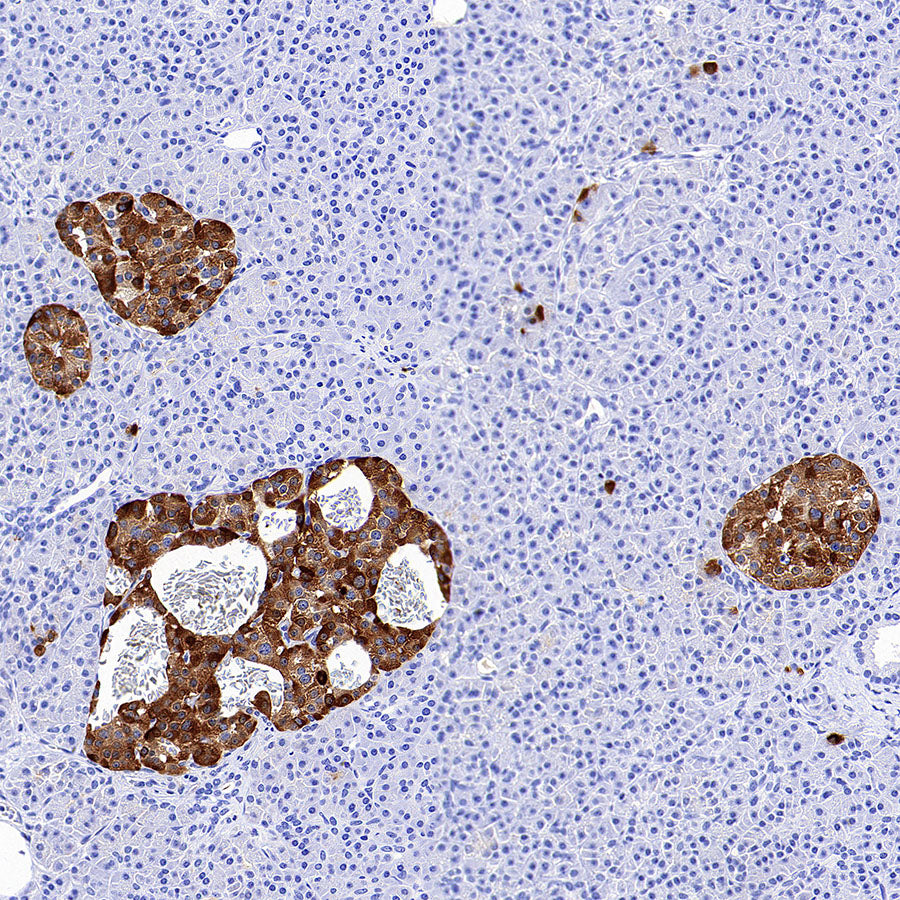 TIMP1 Recombinant Rabbit mAb (S-5147)