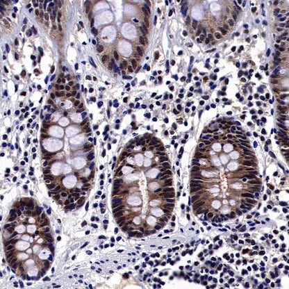 Keap1 Recombinant Rabbit mAb (S-1520-8)
