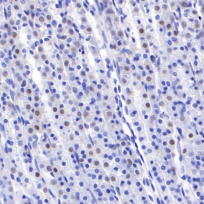 FoxO3a Recombinant Rabbit mAb (S-465-41)