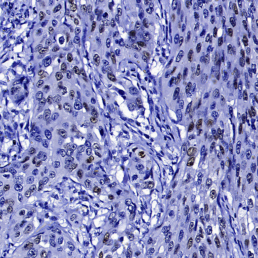 Cyclin E1 Recombinant Rabbit mAb (SDT-4375-29)
