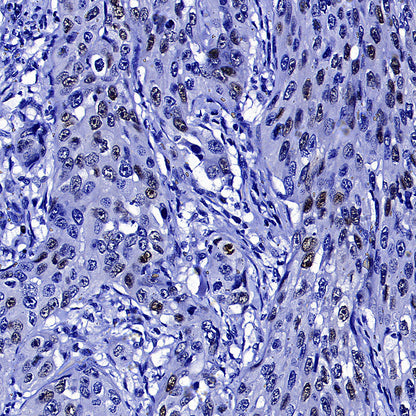Cyclin E1 Recombinant Rabbit mAb (SDT-4375-29)
