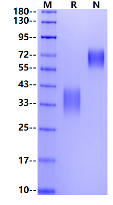 4-1BB Ligand/TNFSF9 His Tag Protein, Rat