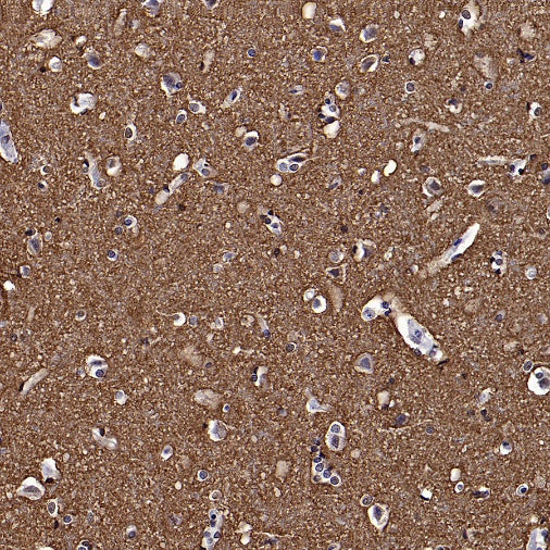 GAP43 Rabbit Polyclonal Antibody-Neuronal Marker
