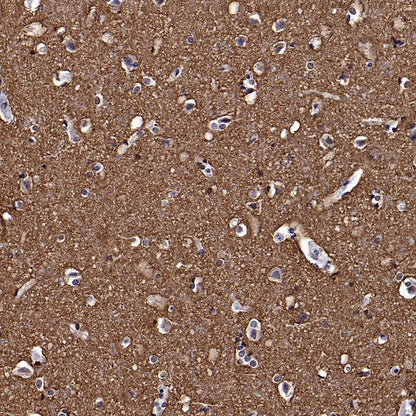 GAP43 Rabbit Polyclonal Antibody-Neuronal Marker