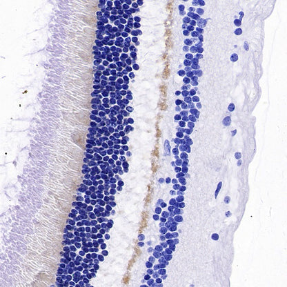 PSD-95 Recombinant Rabbit mAb (S-1518-4)