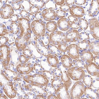 TOM20 Recombinant Rabbit mAb (S-M0015)