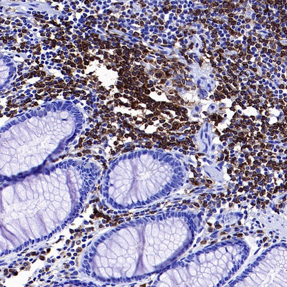 BTK Recombinant Rabbit mAb (SDT-2105-37)