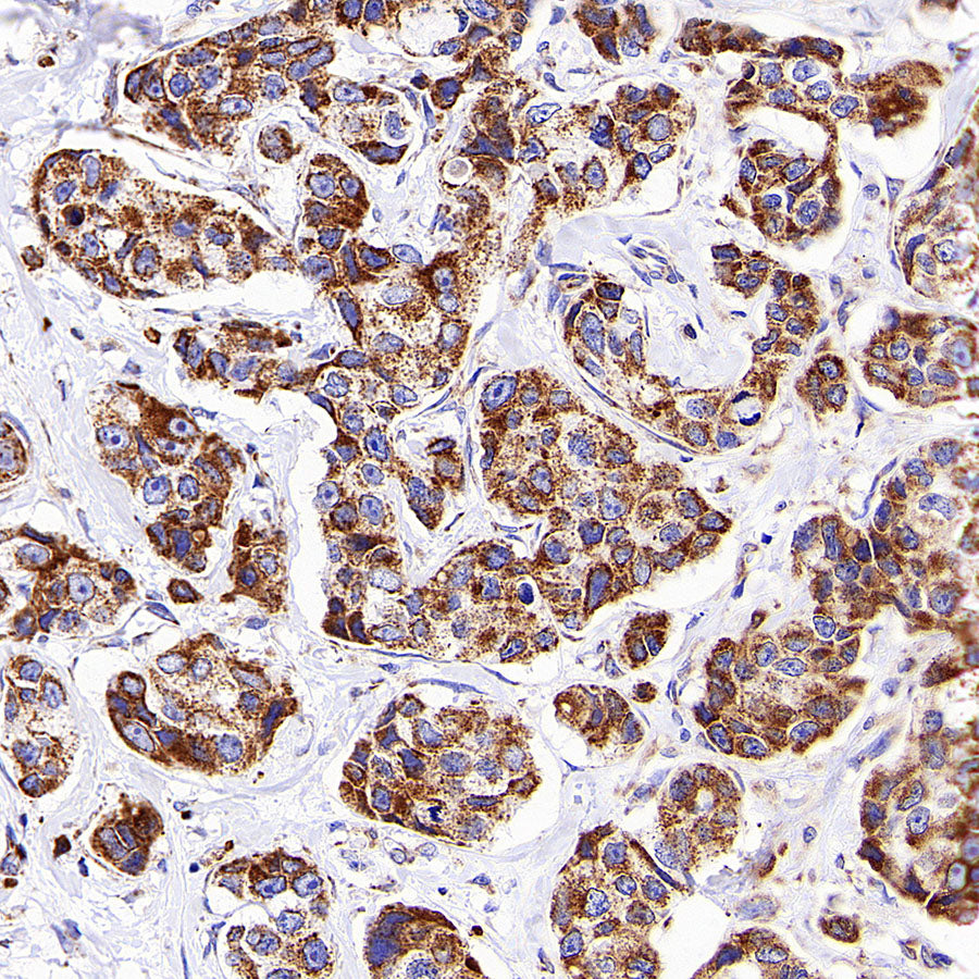 TOM20 Recombinant Rabbit mAb (S-M0015)