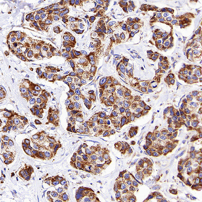 TOM20 Recombinant Rabbit mAb (S-M0015)