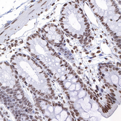 Histone H3 (mono methyl K4) Rabbit polyclonal antibody