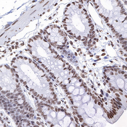 Histone H3 (mono methyl K4) Rabbit polyclonal antibody