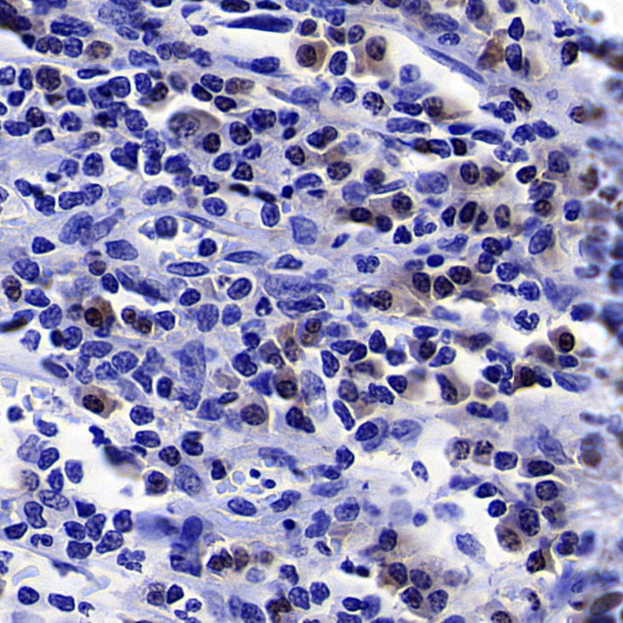 GATA1 Recombinant Rabbit mAb (S-5401)
