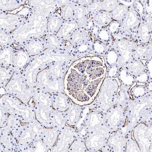 PODXL Recombinant Rabbit mAb (S-2014-9)