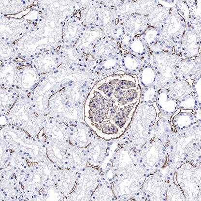 PODXL Recombinant Rabbit mAb (S-2014-9)