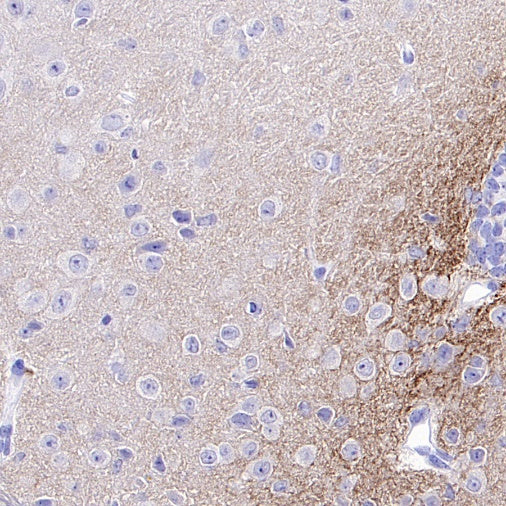 Tenascin C Recombinant Rabbit mAb (S-775-274)