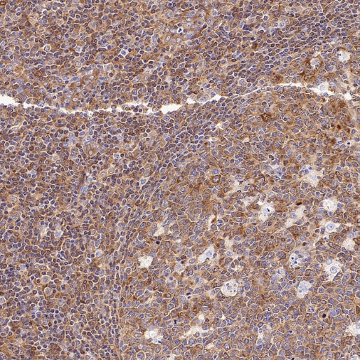 NF-κB2 p100/p52 Recombinant Rabbit mAb (S-2502-208)