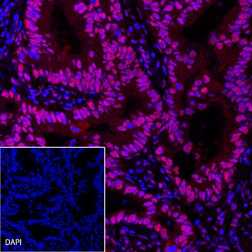 MSH6 Recombinant Rabbit mAb (Alexa Fluor® 555 Conjugate) (SDT-R094)