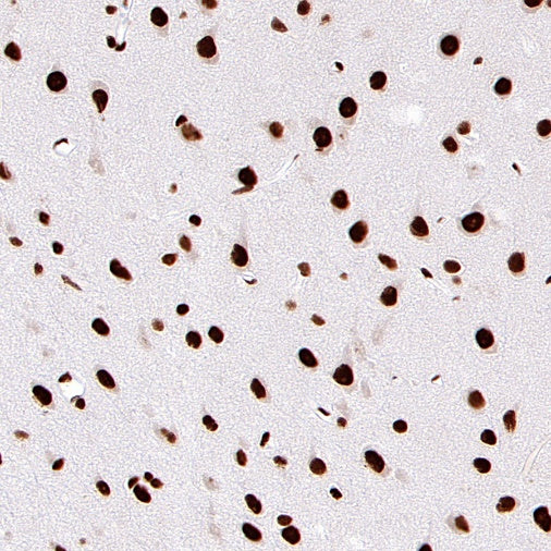 ARID1A Recombinant Rabbit mAb (S-440-27)