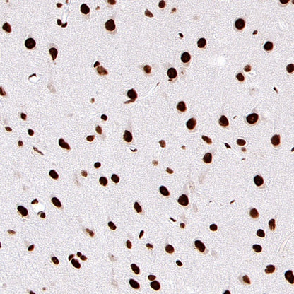 ARID1A Recombinant Rabbit mAb (S-440-27)