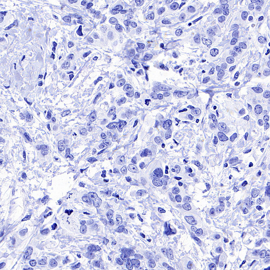 AGXT Recombinant Rabbit mAb (S-3586-30)