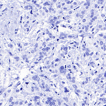 AGXT Recombinant Rabbit mAb (S-3586-30)