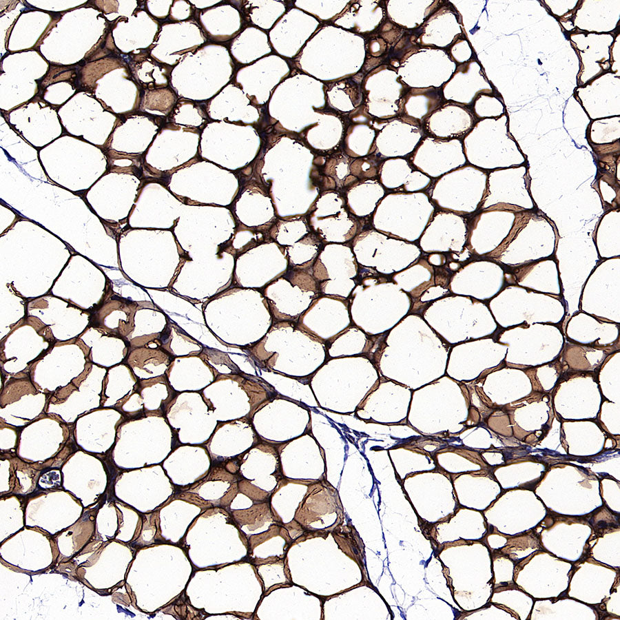 Perilipin-1 Recombinant Rabbit mAb (S-3093-31)