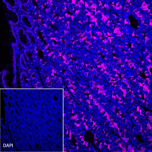 Claudin 18.2 Recombinant Rabbit mAb (Alexa Fluor® 647 Conjugate) (S-102-24)