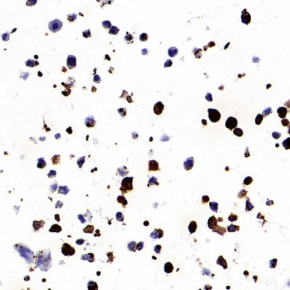 KRAS (mutated GQ60GK) + (mutated Q61K) Recombinant Rabbit mAb (S-604-4)